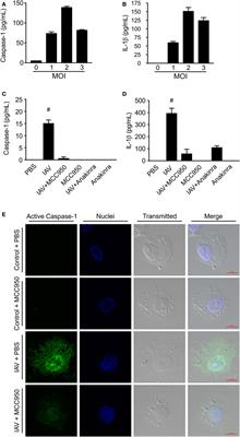 Inhibition of the NOD-Like Receptor Protein 3 Inflammasome Is Protective in Juvenile Influenza A Virus Infection